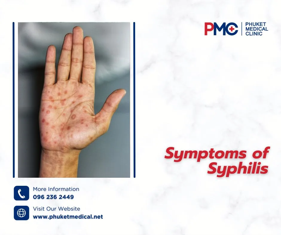 Symptoms of Syphilis