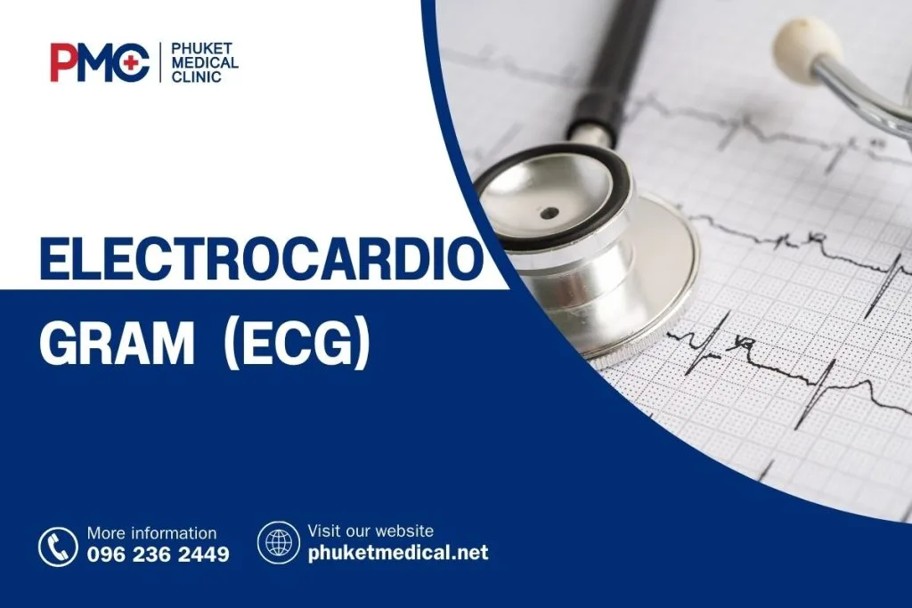 Electrocardiogram (ECG)