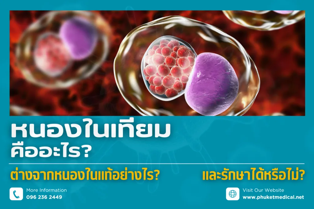 non-gonococcal urethritis