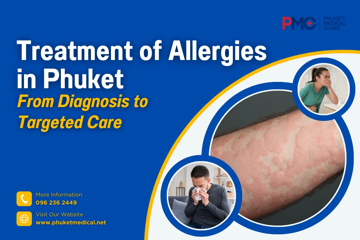 Treatment of Allergies in Phuket From Diagnosis to Targeted Care