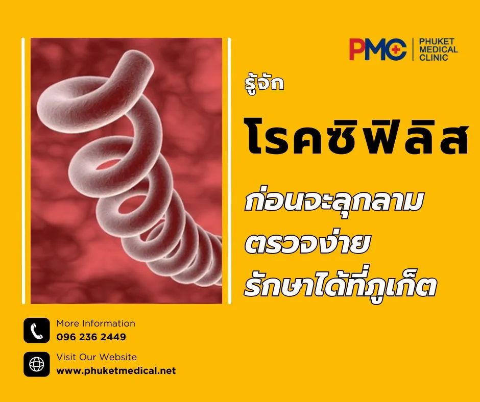 รู้จักโรคซิฟิลิสก่อนจะลุกลาม ตรวจง่าย รักษาได้ที่ภูเก็ต