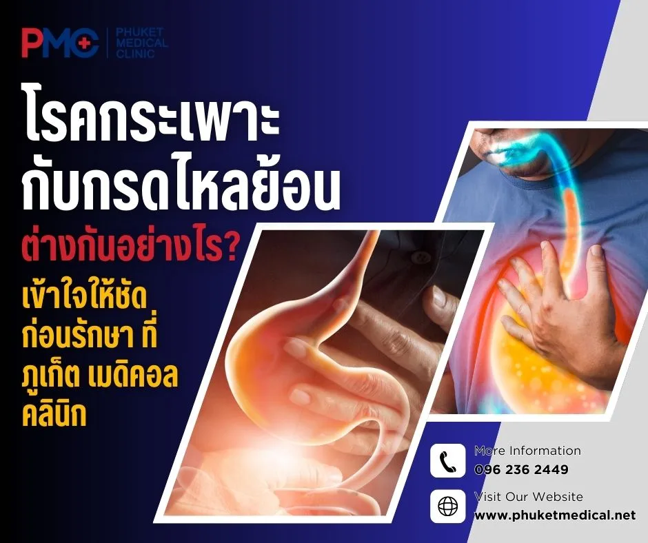 โรคกระเพาะกับกรดไหลย้อน ต่างกันอย่างไร? เข้าใจให้ชัดก่อนรักษา ที่ ภูเก็ต เมดิคอล คลินิก