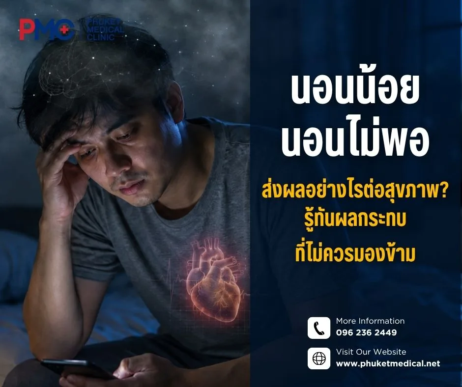 นอนน้อย นอนไม่พอ ส่งผลอย่างไรต่อสุขภาพ? รู้ทันผลกระทบที่ไม่ควรมองข้าม