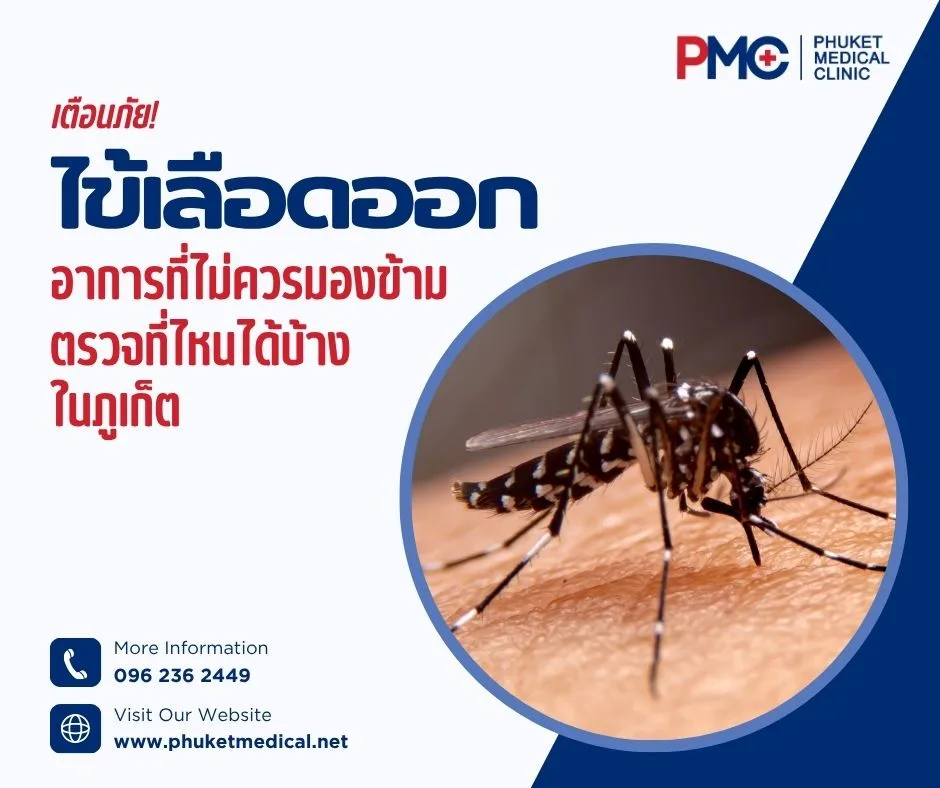 เตือนภัยไข้เลือดออก! อาการที่ไม่ควรมองข้าม ตรวจที่ไหนได้บ้างในภูเก็ต