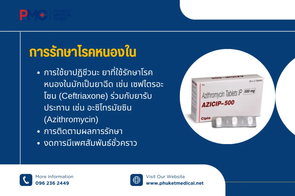 การรักษา โรคหนองใน