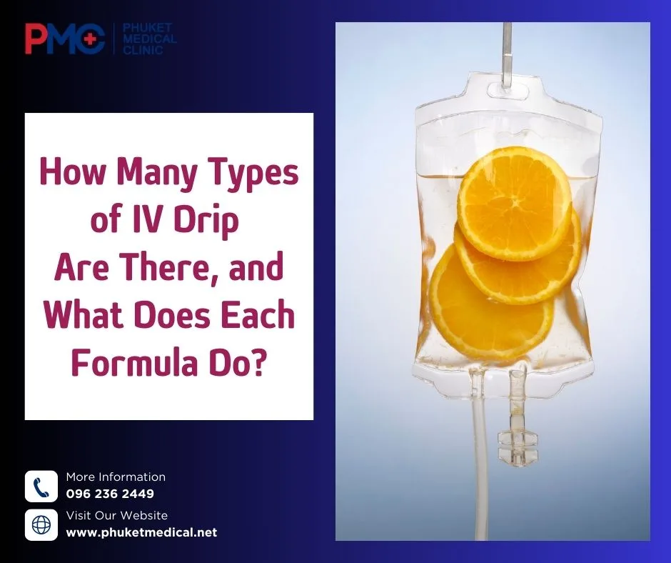 How Many Types of IV Drip Are There, and What Does Each Formula Do