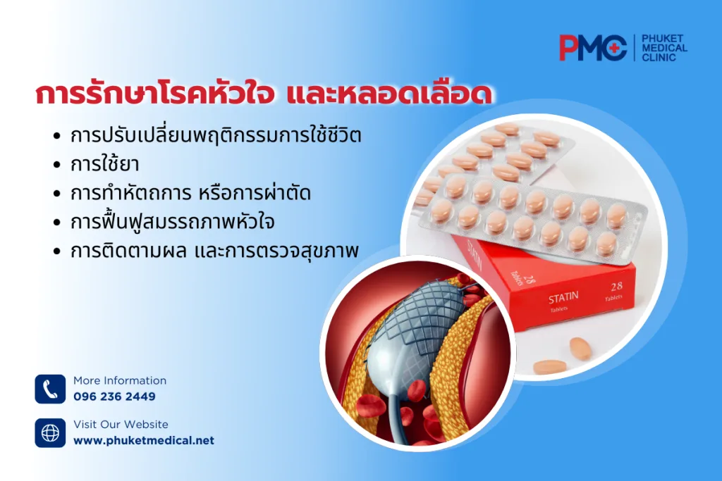การรักษาโรคหัวใจและหลอดเลือด